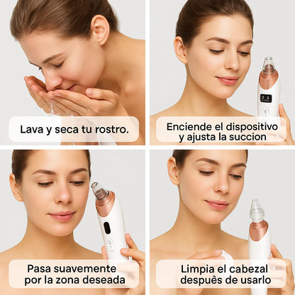 VivaSkin - Extractor de Impuresas